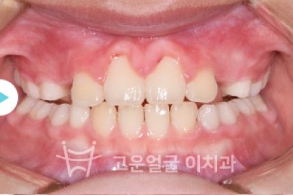 치료후기 이미지